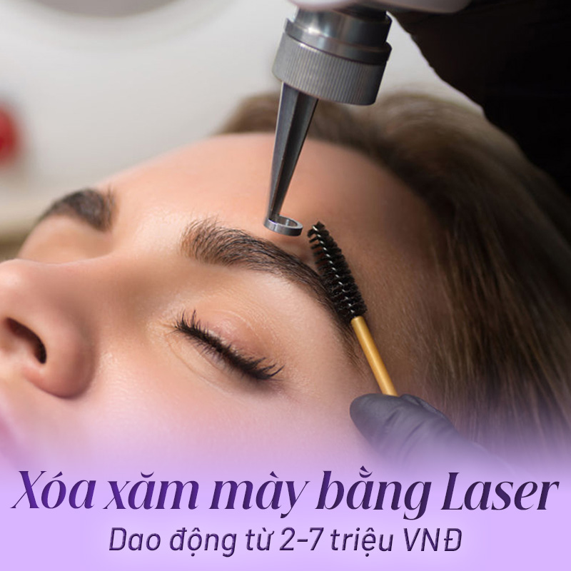 Xoá laser chân mày