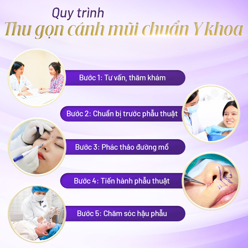 cắt cánh mũi bị lệch