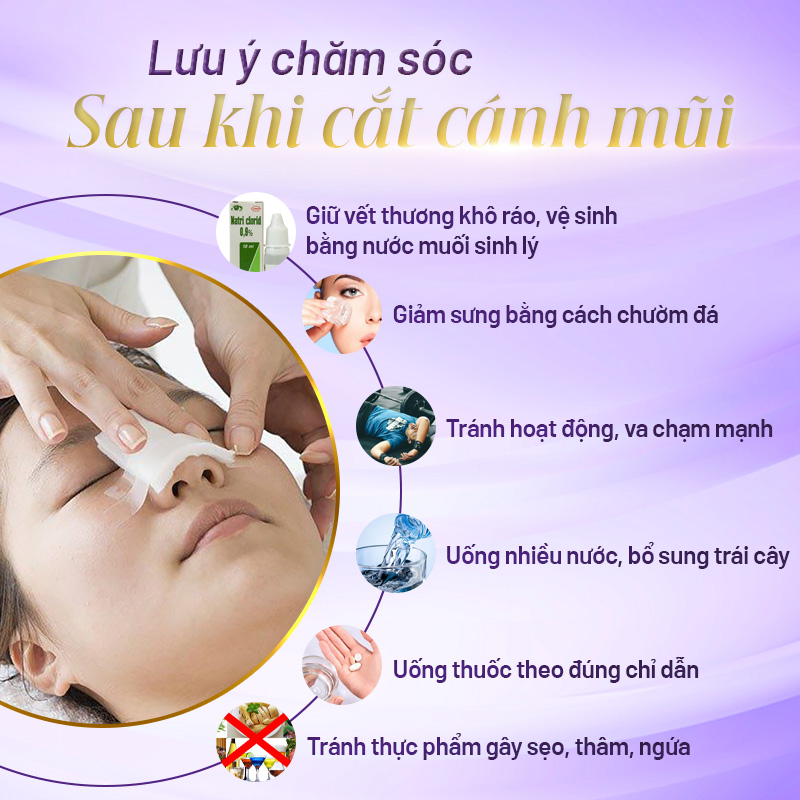 cắt cánh mũi nên kiêng gì