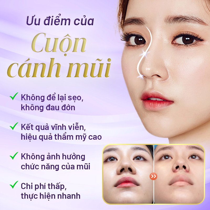 cuộn cánh mũi có phá tướng không