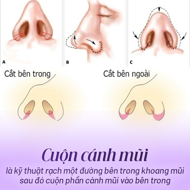 cuộn cánh mũi là gì