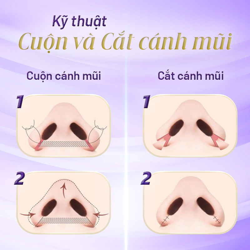 kỹ thuật cuộn cánh mũi