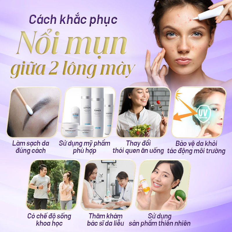 nguyên nhân mọc mụn ở giữa 2 lông mày