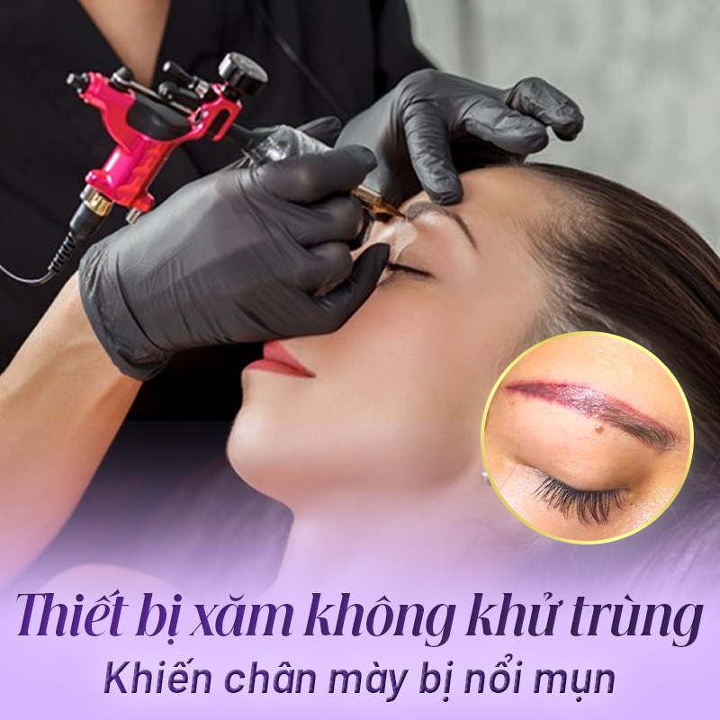 nguyên nhân phun lông mày bị nổi mụn nước