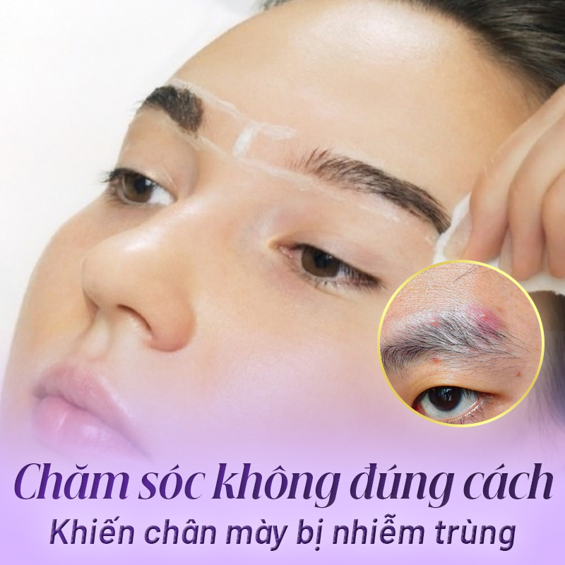 phun lông mày bị nổi mụn nước có nguy hiểm không