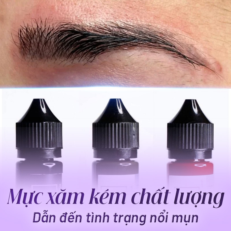 phun lông mày bị nổi mụn nước là do đâu