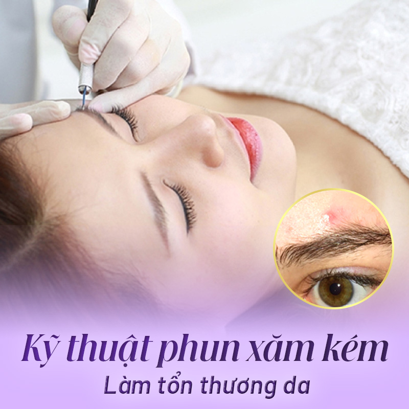 phun lông mày bị nổi mụn nước phải làm sao