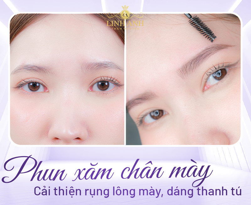 rụng lông mày phải làm thế nào