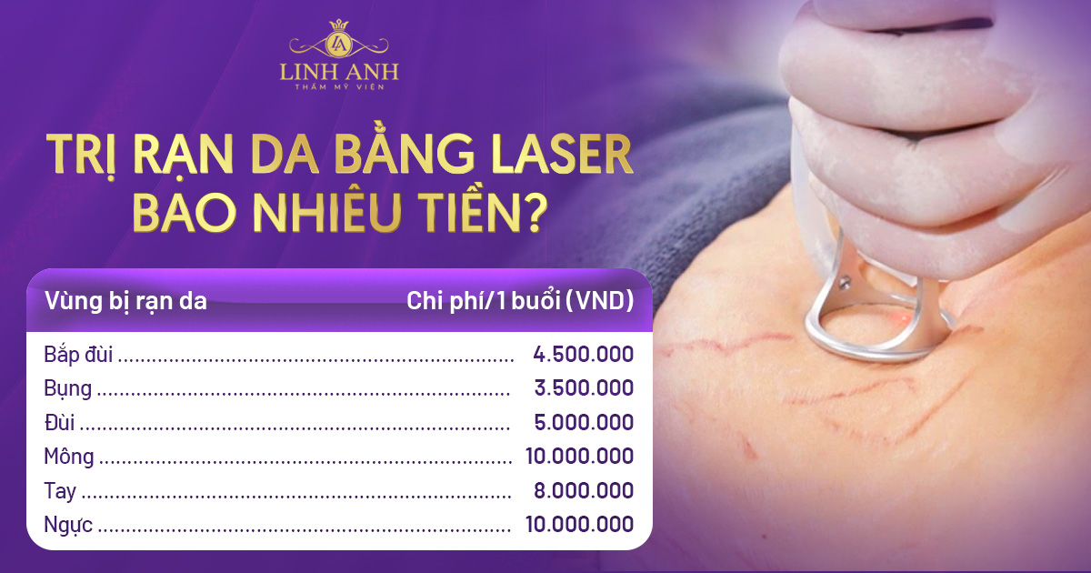 Trị rạn da bằng laser bao nhiêu tiền? Cập nhật bảng giá mới nhất