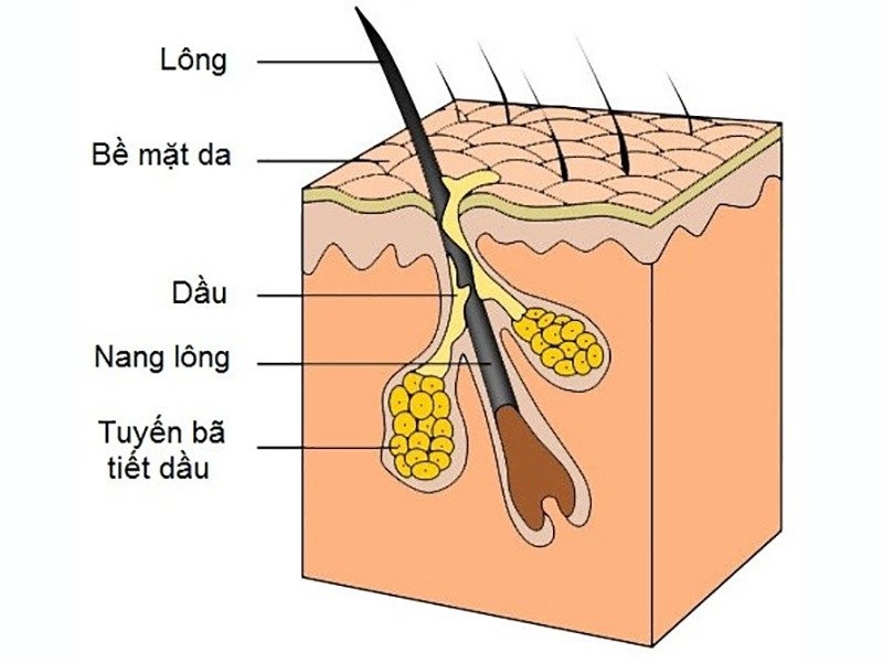 điều trị mụn nổi ở chân mày