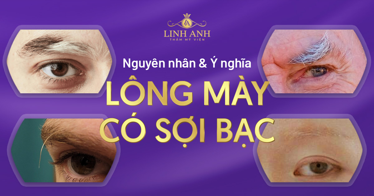 lông mày có sợi bạc