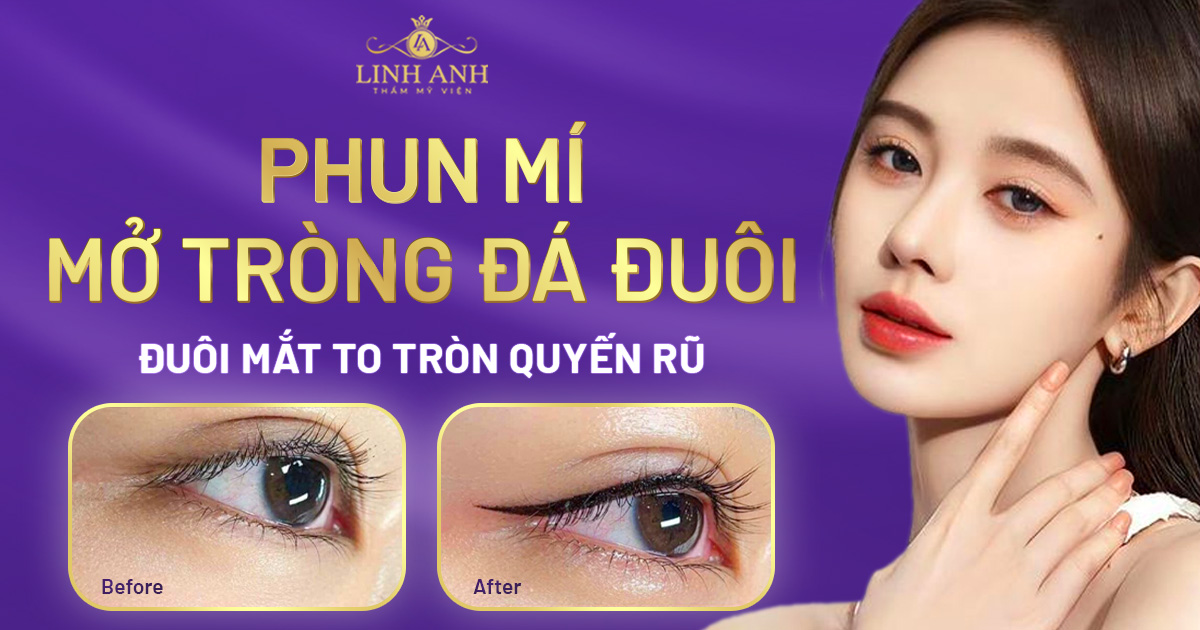 phun mí mở tròng đá đuôi