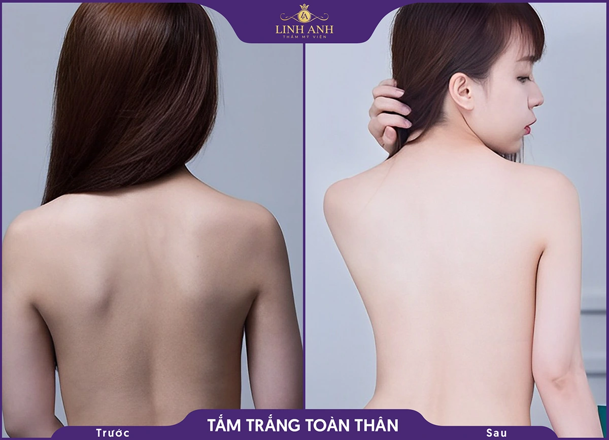 tam trang bf 2