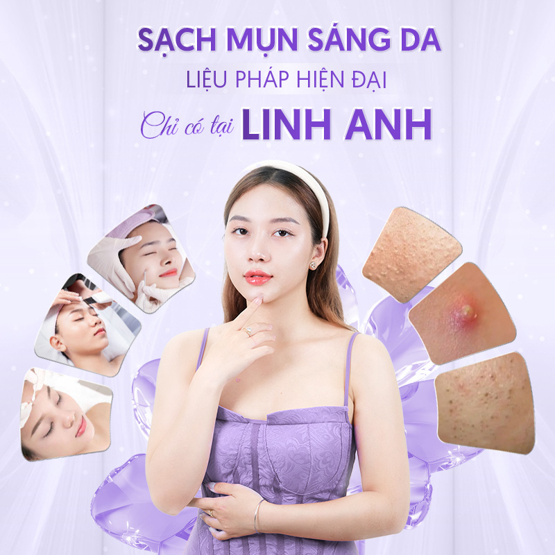 toi uu dich vu tri mun 1