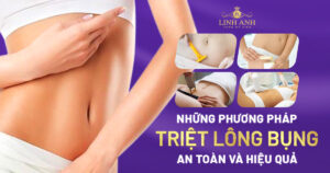 triệt lông bụng