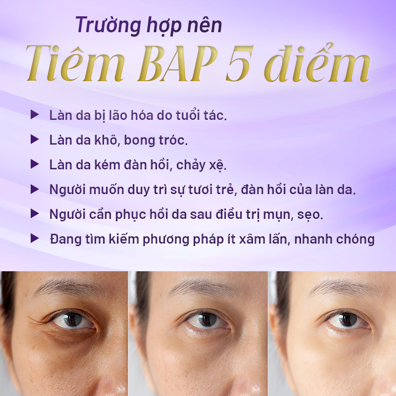 giá tiêm bap 5 điểm
