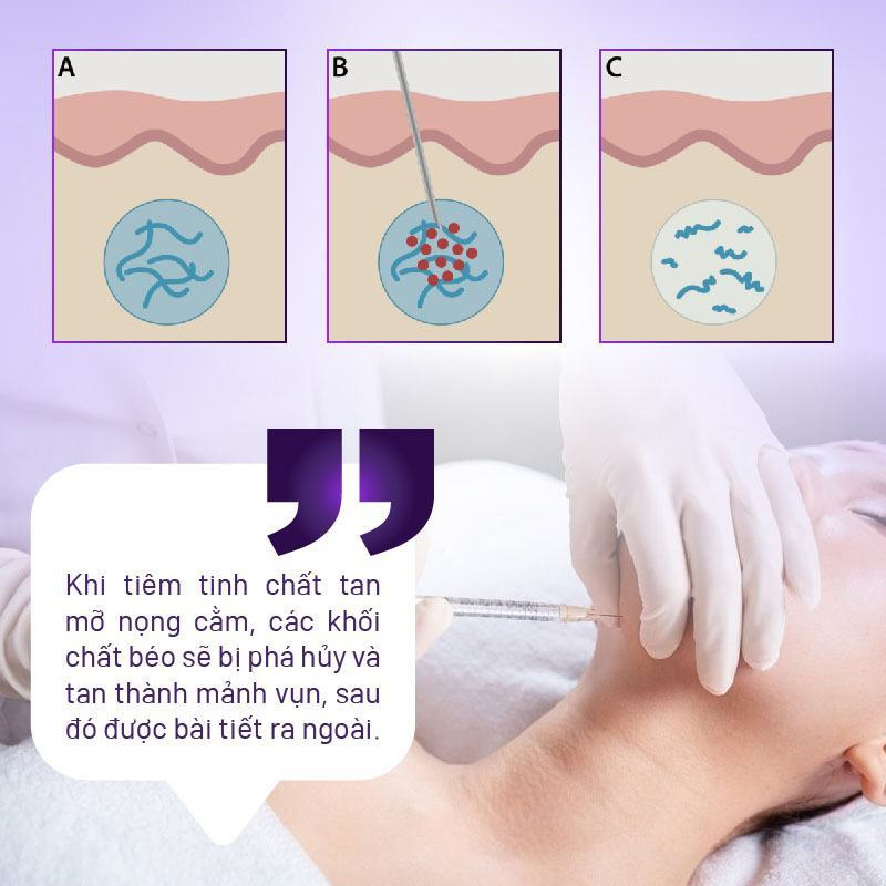 xóa nọng cằm giá bao nhiêu xóa nọng cằm giá bao nhiêu