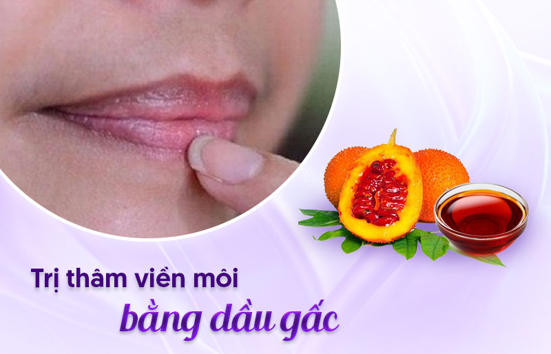 Cải thiện viền môi thâm với dầu gấc - Viện thẩm mỹ quốc tế Linh Anh