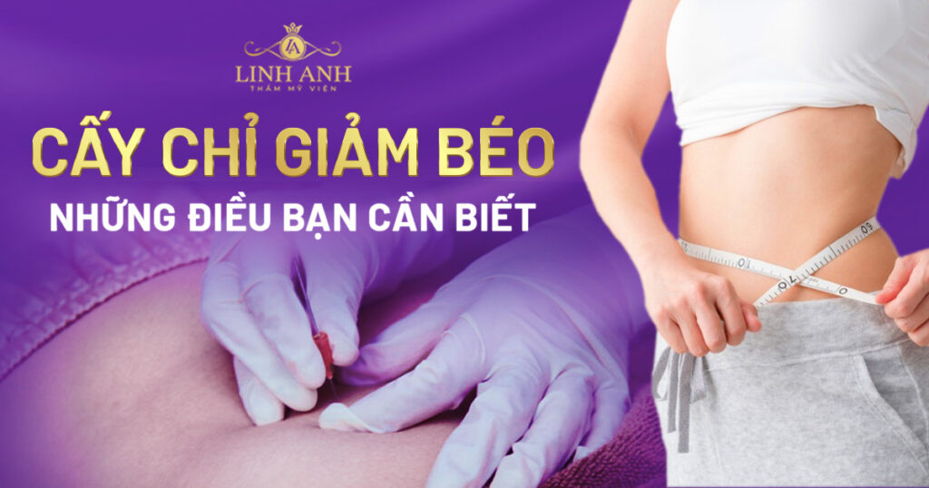 cấy chỉ giảm béo