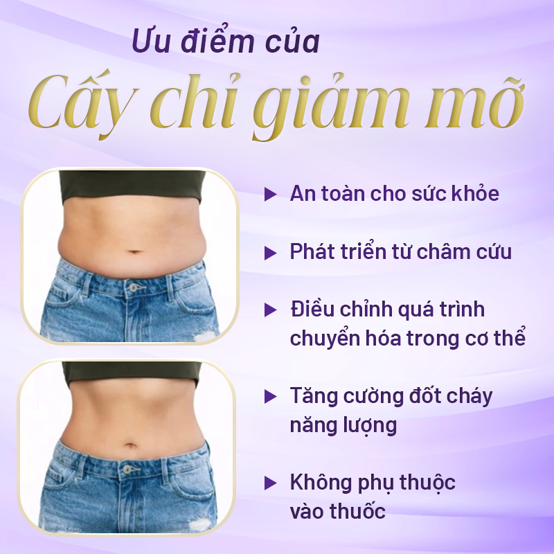 cấy chỉ giảm mỡ bụng có tốt không