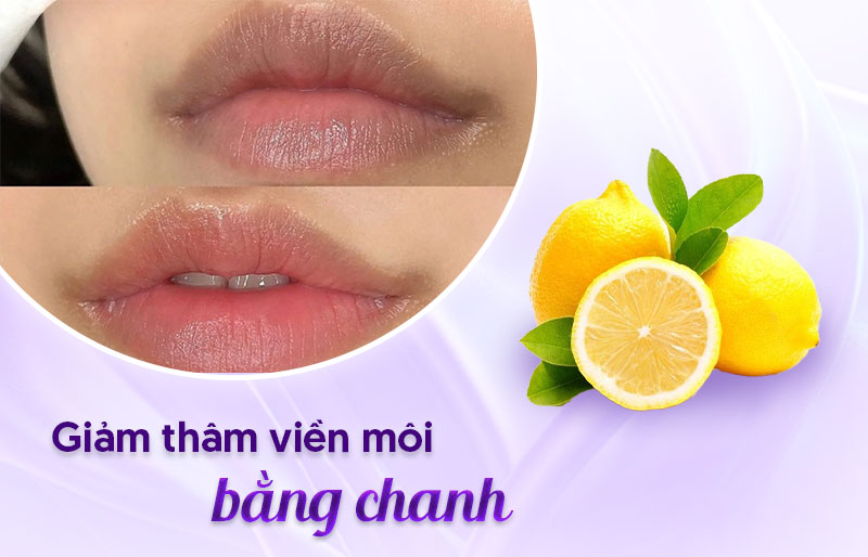 Chanh tươi giảm thâm viền môi - Viện thẩm mỹ quốc tế Linh Anh