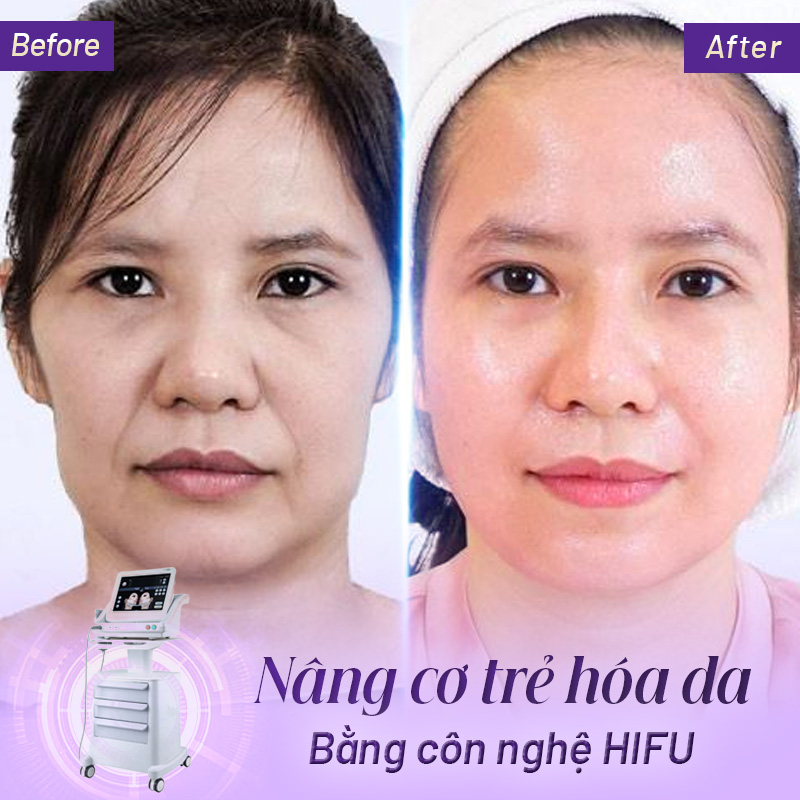 công nghệ làm trẻ hóa da