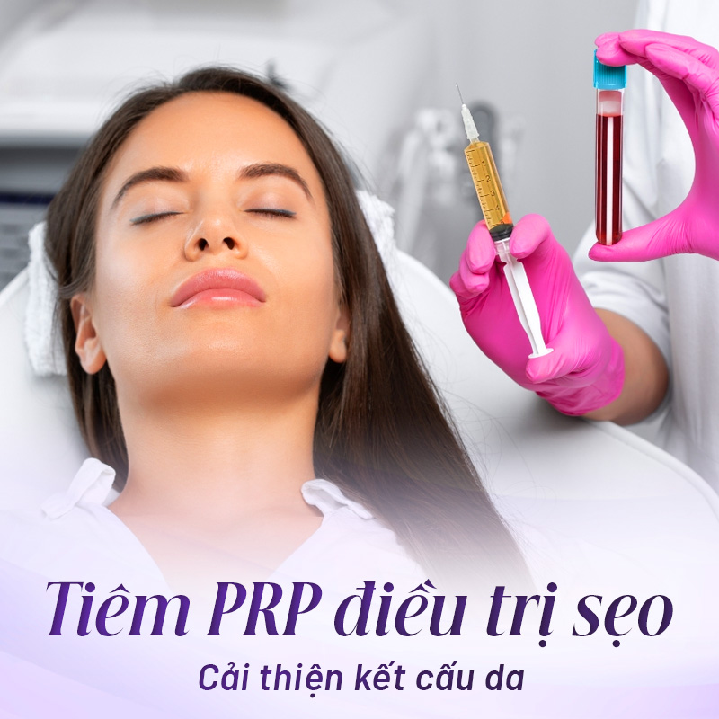 dịch vụ trị sẹo hiệu quả
