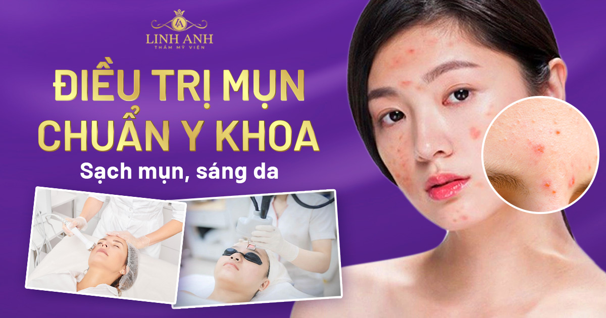 điều trị mụn