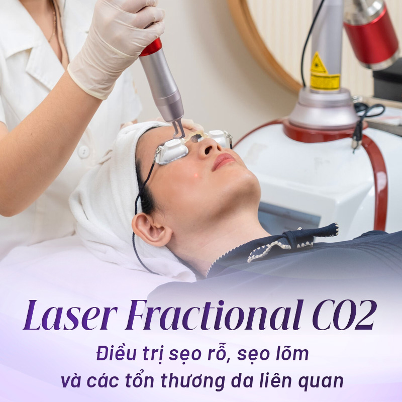điều trị sẹo công nghệ cao