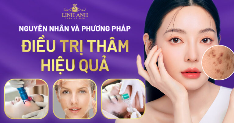 Nguyên nhân và các phương pháp điều trị thâm hiệu quả