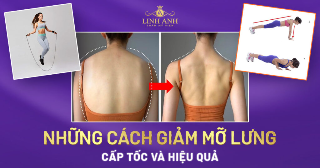 giảm mỡ lưng