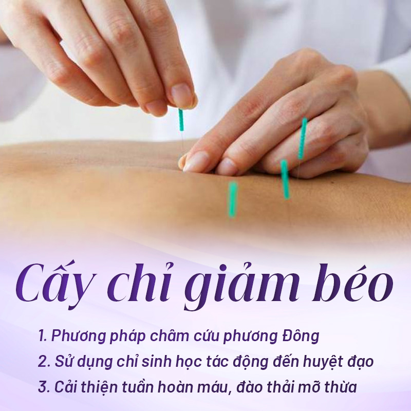 phác đồ cấy chỉ giảm mỡ bụng