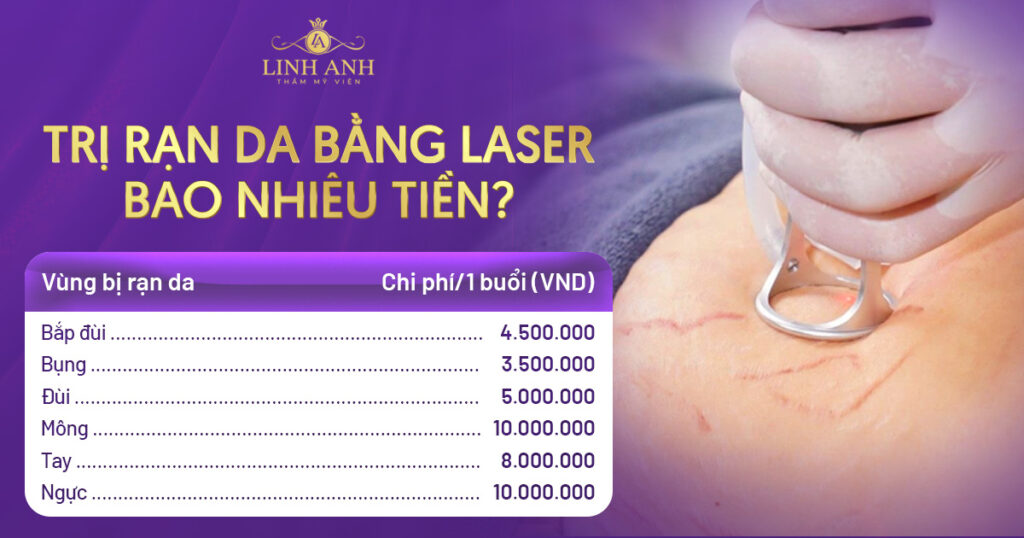 trị rạn da bằng laser bao nhiêu tiền