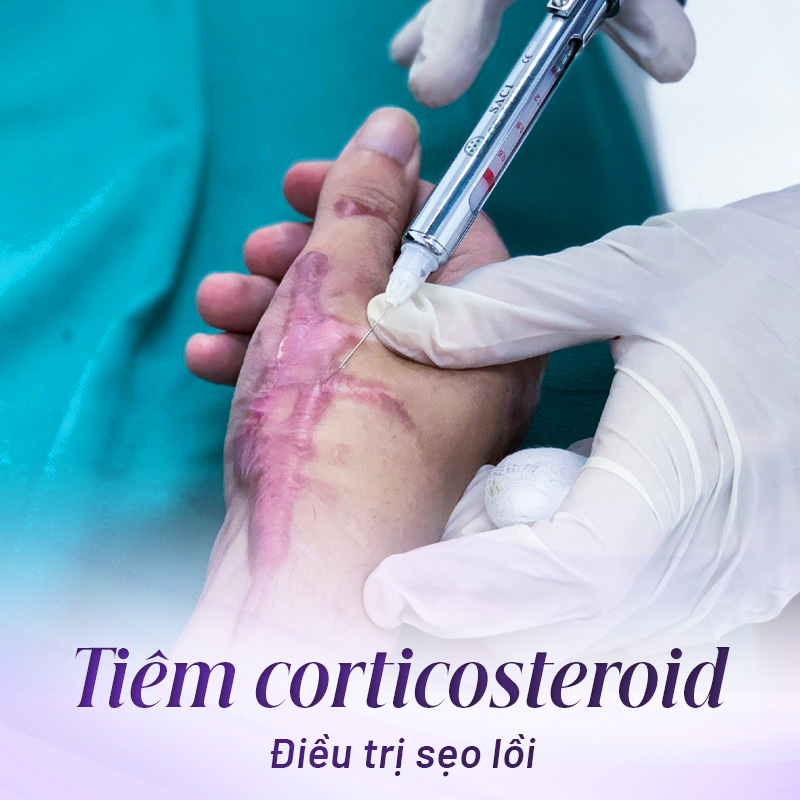 trị sẹo hiệu quả tại Linh Anh