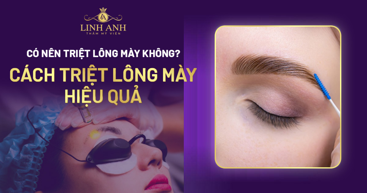Triệt lông mày thừa AN TOÀN, vĩnh viễn hiệu quả cao