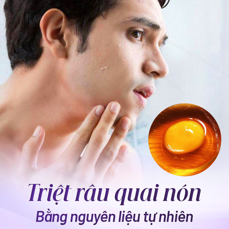 triệt râu quai nón ở nam