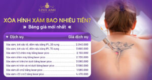 xóa hình xăm bao nhiêu tiền