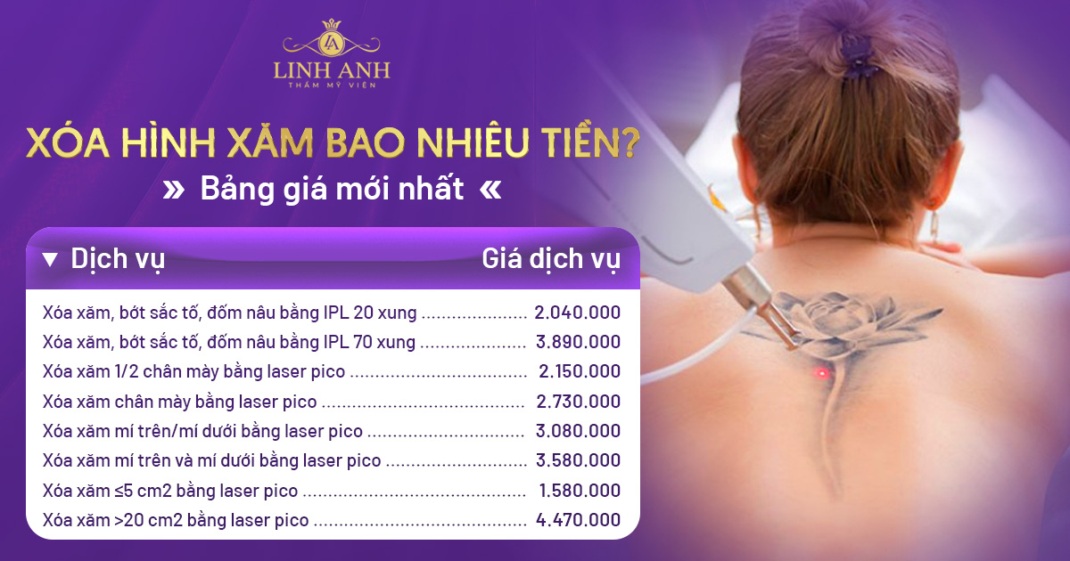 xóa hình xăm bao nhiêu tiền