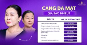 Căng da mặt giá bao nhiêu