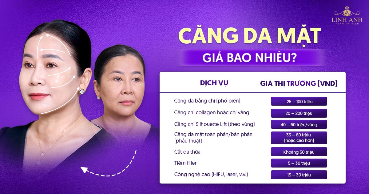 Căng da mặt giá bao nhiêu