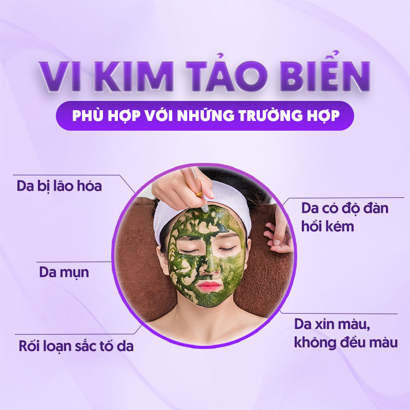 chi phí vi kim tảo biển