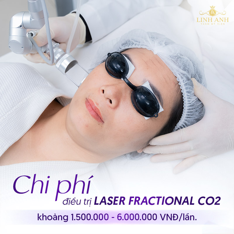 laser co2 fractional giá bao nhiêu
