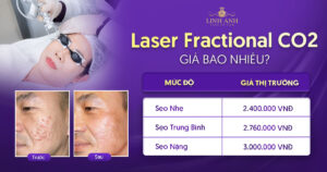 Laser Fractional CO2 giá bao nhiêu