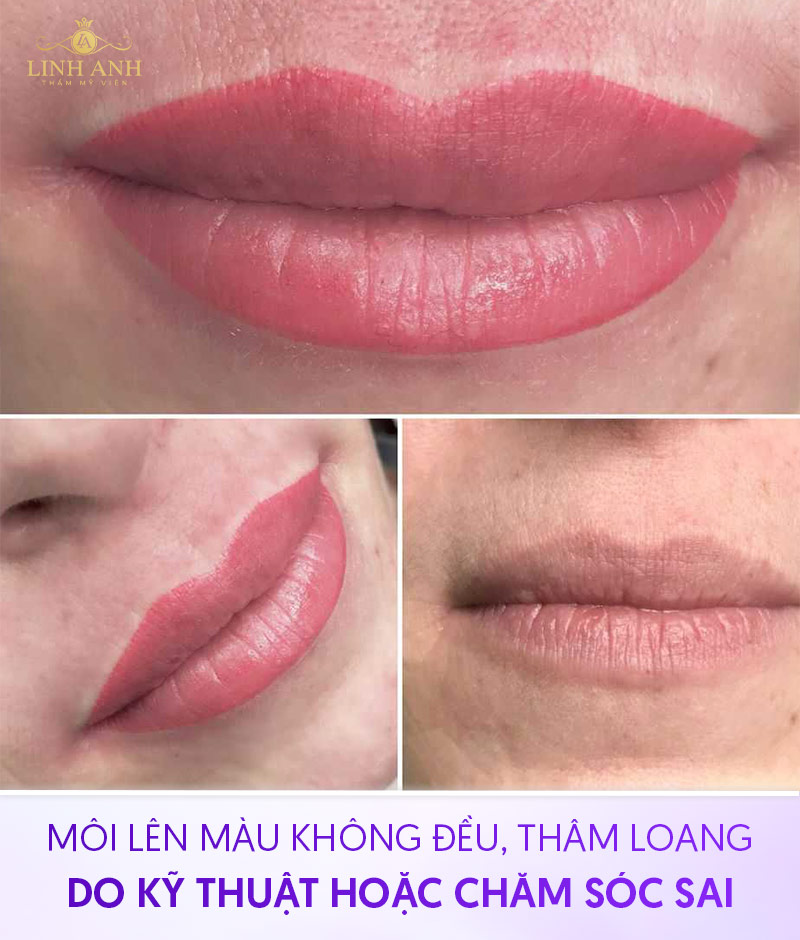 Xăm môi có an toàn không