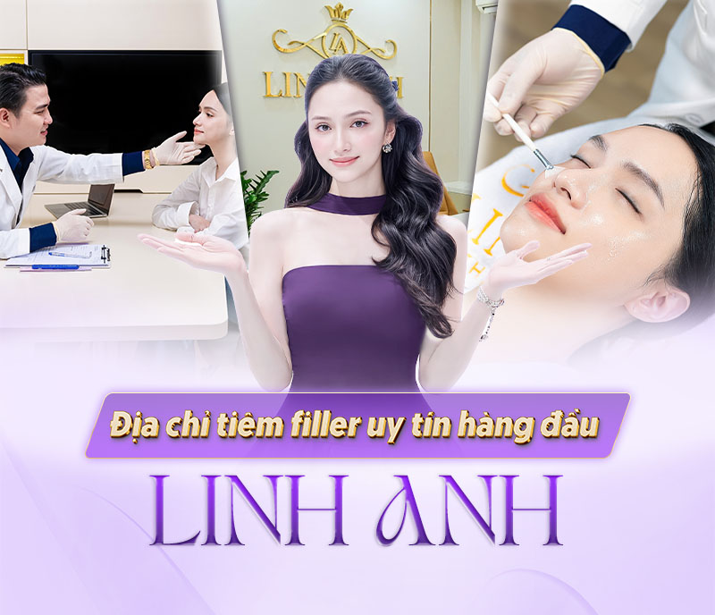 bảng giá tiêm filler