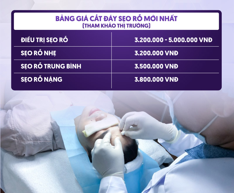 bảng giá cắt đáy sẹo rỗ bảng giá cắt đáy sẹo rỗ