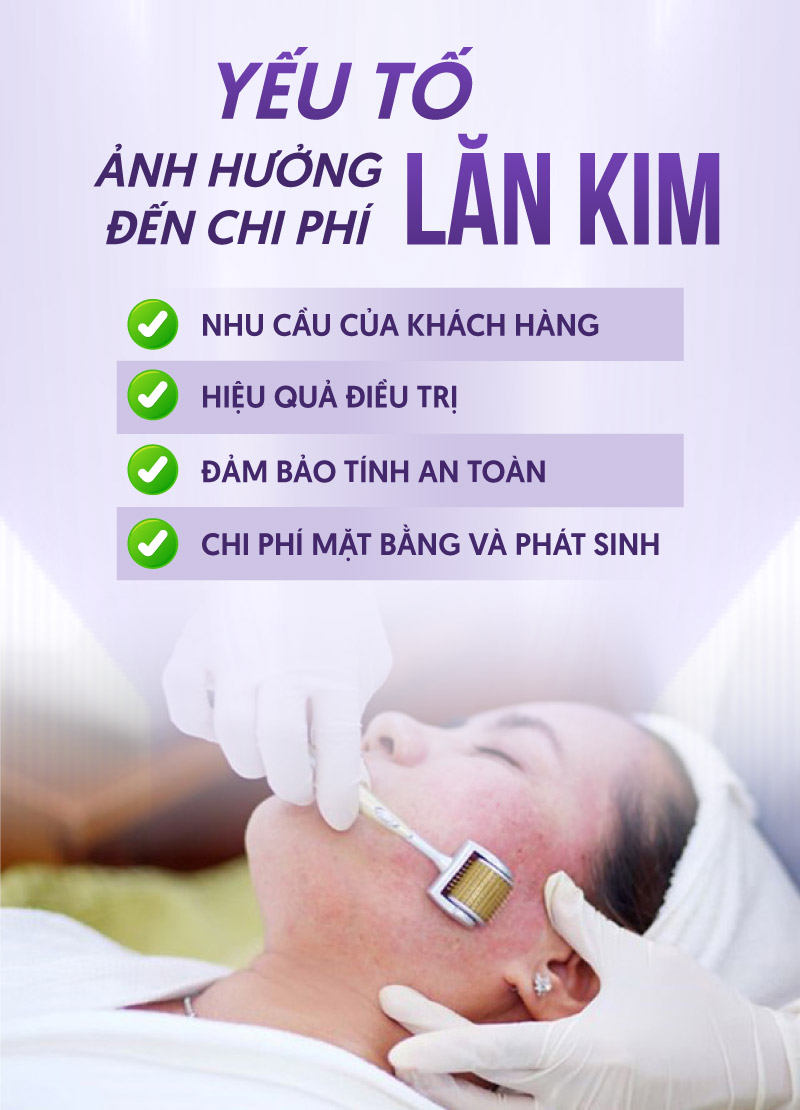 bảng giá lăn kim chi tiết