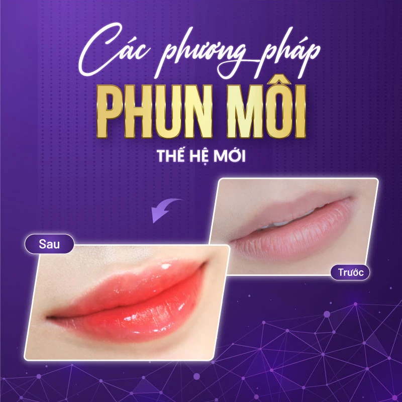 cac phuong phap phun moi 32