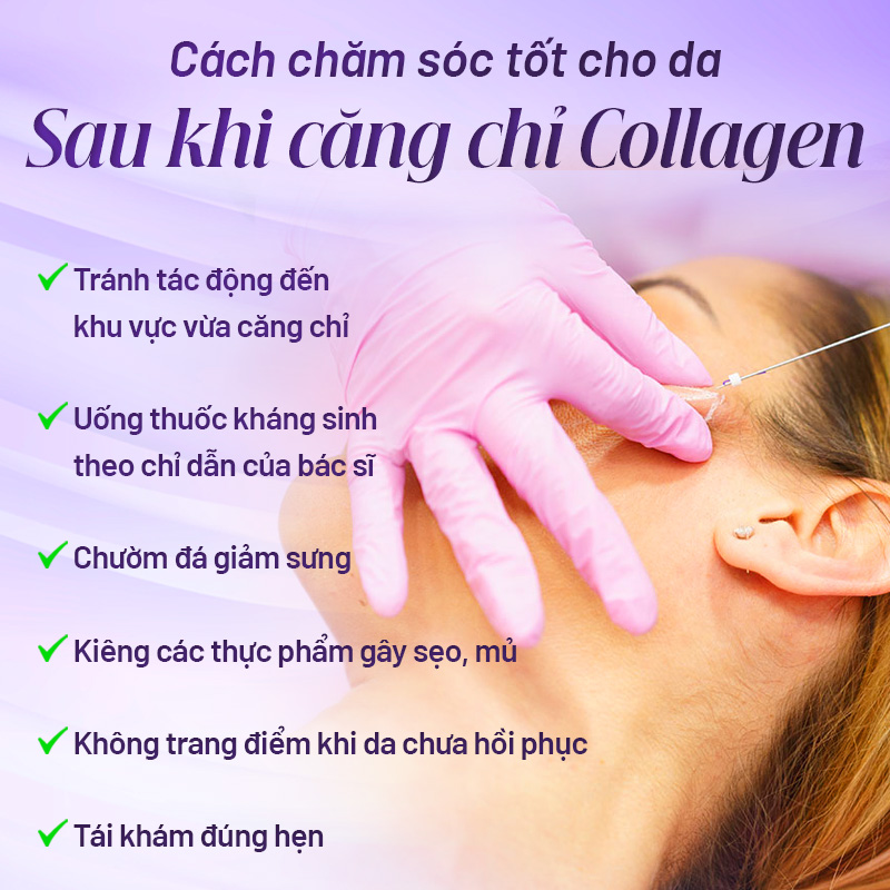 chi phí căng chỉ collagen