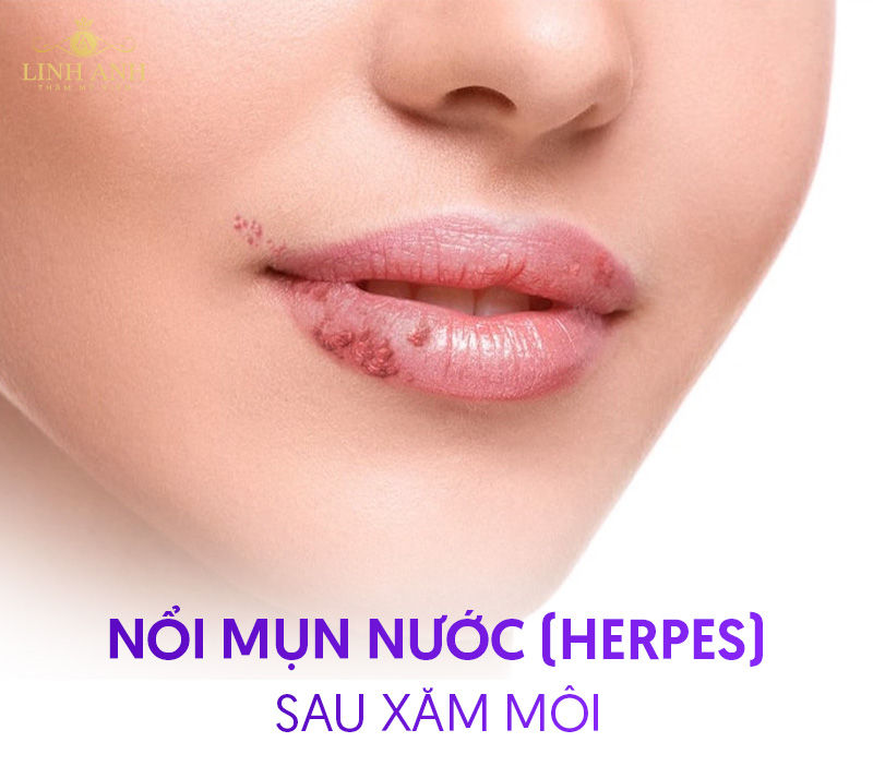 có nên đi Xăm môi không